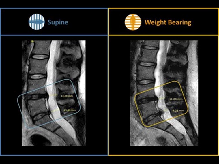 Specialty weight-bearing MRI scan high quality