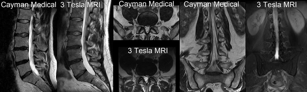 Open MRI scan high quality