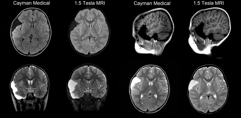 Pediatric MRI scan high quality
