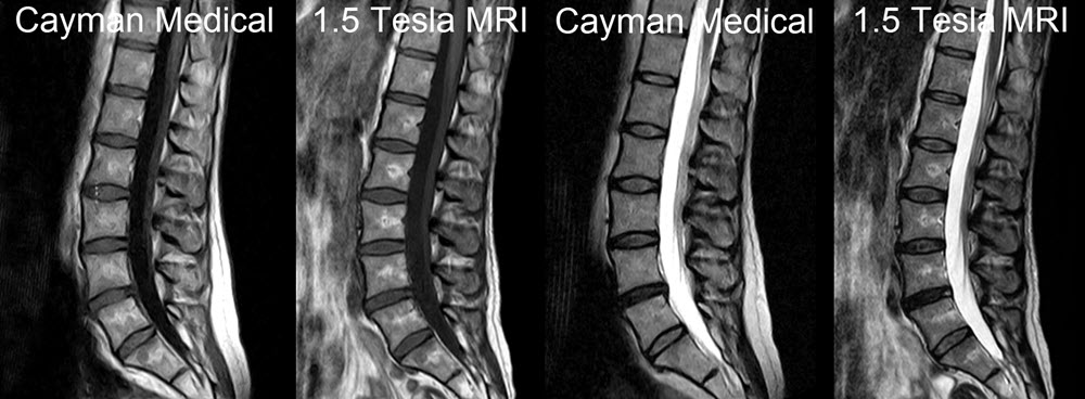 Same patient - scanned first in a 1.5T scanner (right) and then with our open MRI scanner (left)